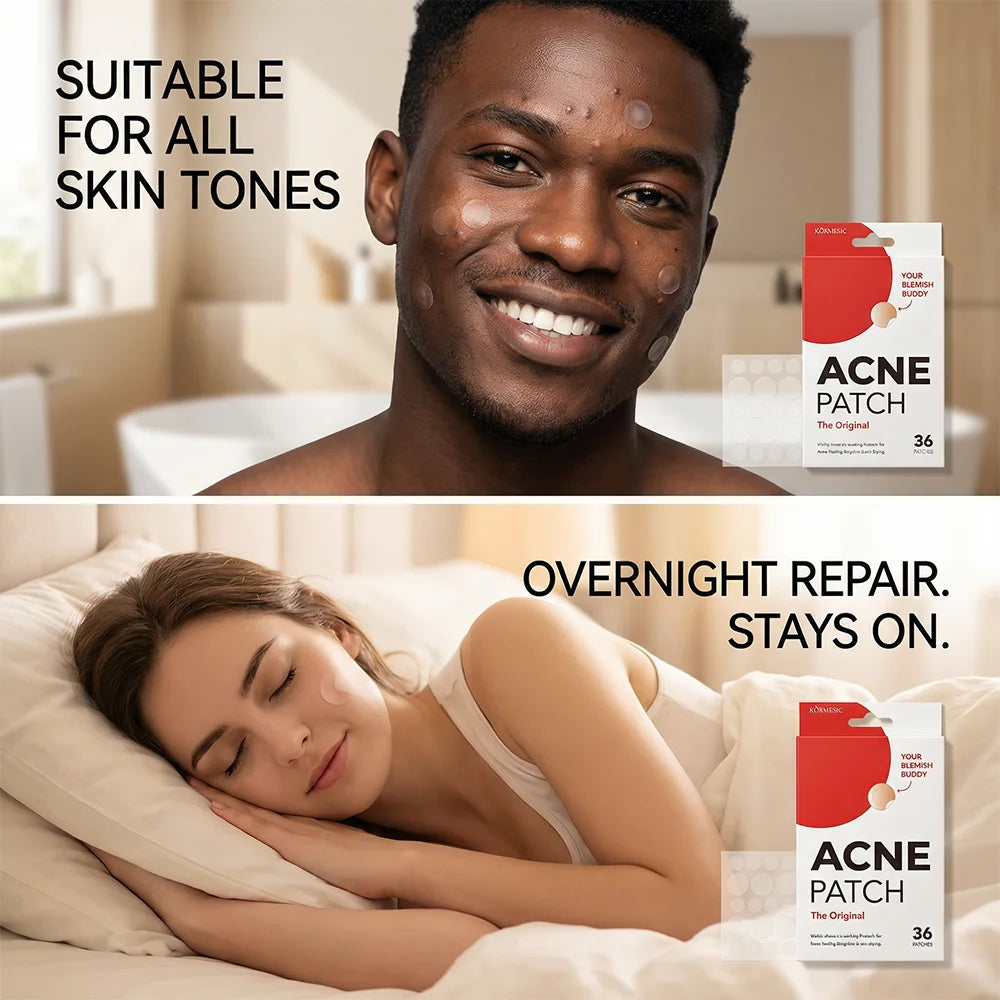 Acne Patches