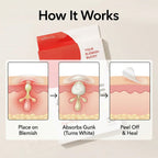 Acne Patches